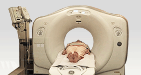 Ultra-low radiation CT(Discovery 750HD by GE) image